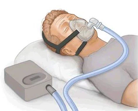 ventilator ventilator