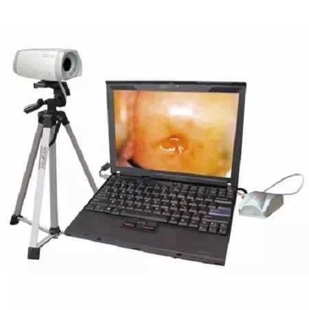 product-450-452 electronic dndoscope