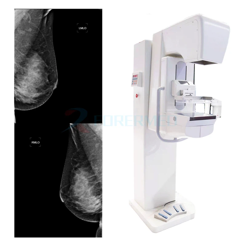 mammography machine mammography machine