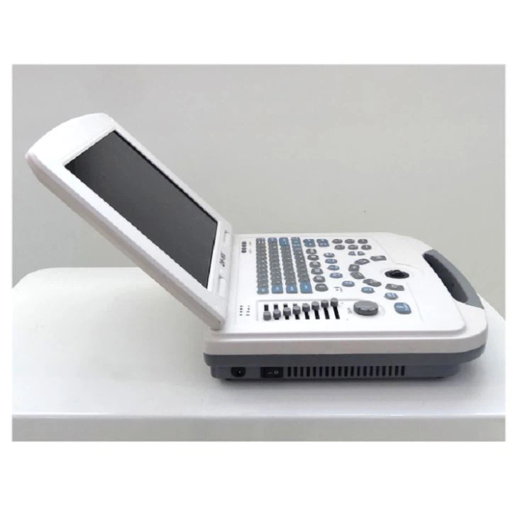 OB-GYN Ultrasound System OB-GYN Ultrasound System