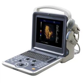 Pengimbas Ultrasound Warna Mudah Alih 4D