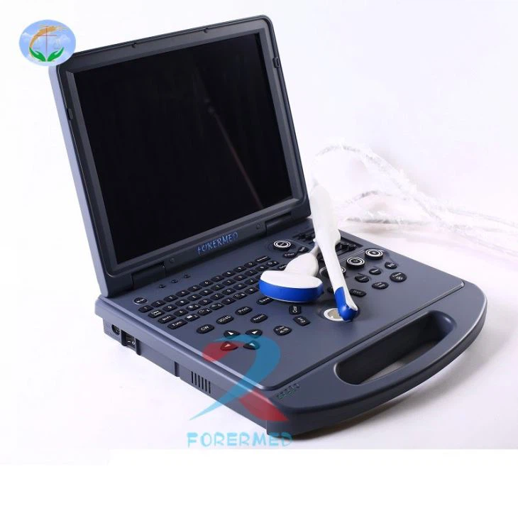 3D Doppler USG Scanner 3D Doppler USG Scanner