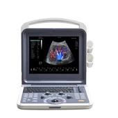 Pengimbas Doppler Warna Portable 3D / 4D