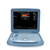 Pengimbas Ultrasound Skrin LCD