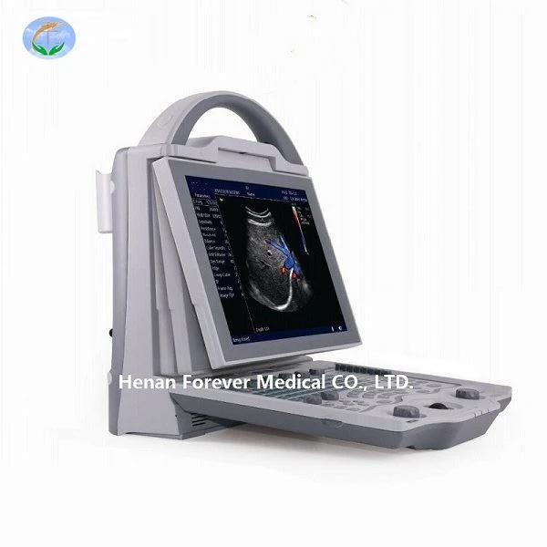 Sistem Diagnostik Ultrasound Hitam Putih