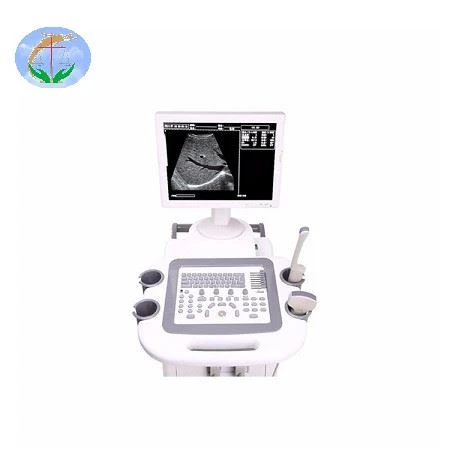 Full Digital Trolley Ultrasound Scanner Full Digital Trolley Ultrasound Scanner