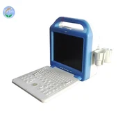 Pengimbas Ultrasound Komputer Riba Digital